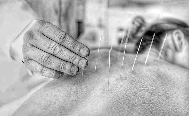 Astrology with needles: why acupuncture is pseudoscience
